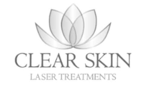 Clear skin laser treatments