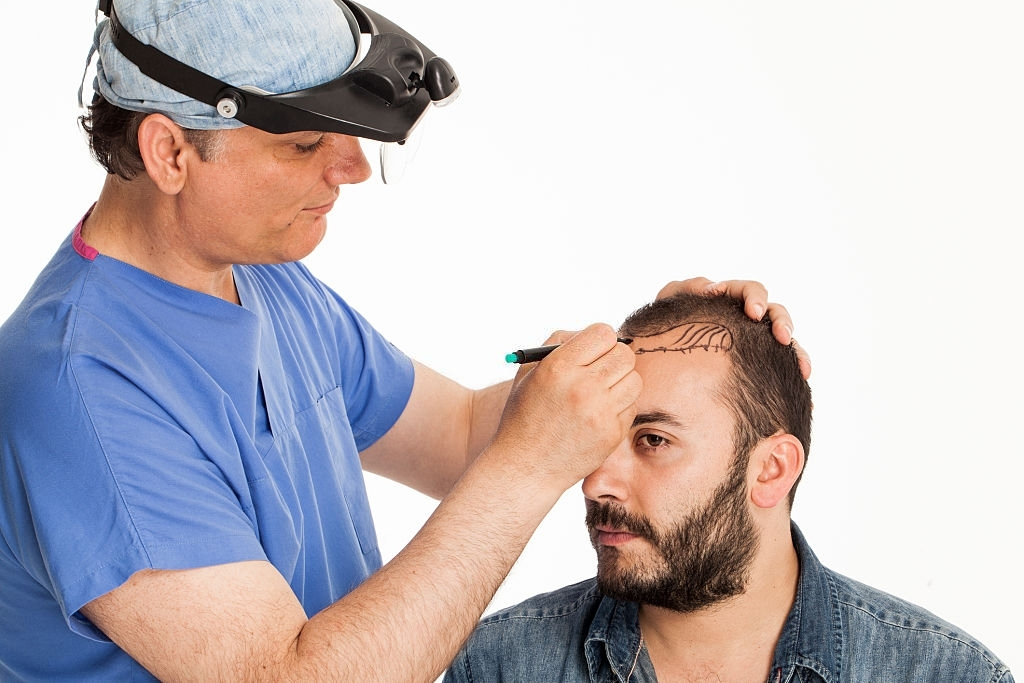 Hair Transplant in Islamabad 