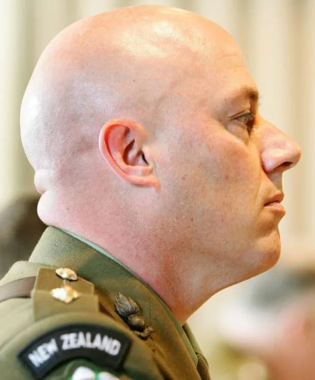Allan Kinsella