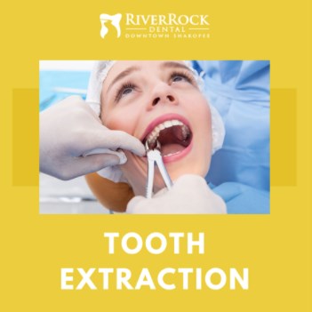 TOOTH EXTRATION