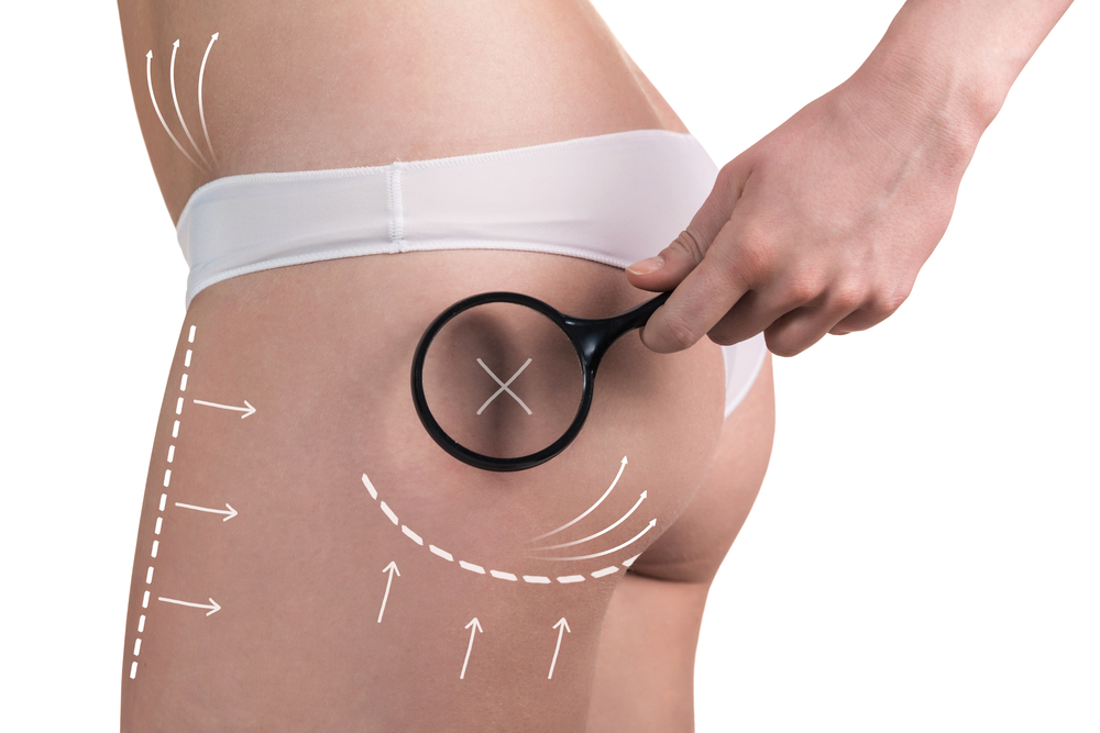 What is Body Contouring and its Benefits