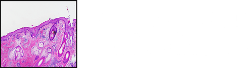 Dermatology Marketing