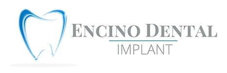 Encino Dental Implant