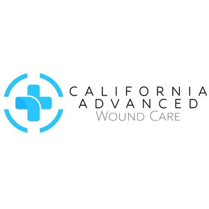 Calwounds